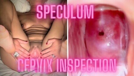 Hot Girl Lets Us Explore Her Cervix and Open Her Up with a Speculum